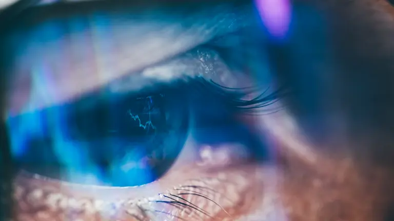 Eye